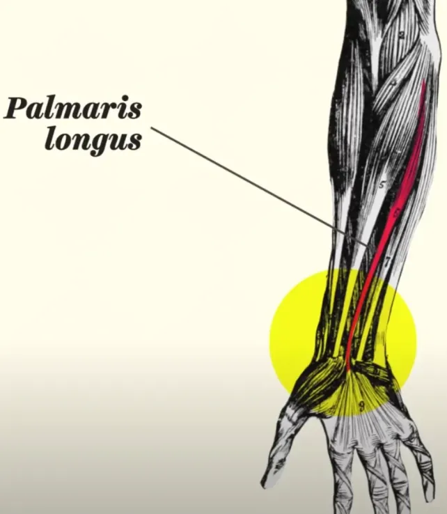 palmaris longus tendon